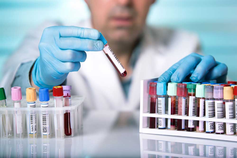 Anti HBS Nedir Nas l Bula r De erleri Ve Belirtileri anti-hbs-nedir-nas-l-bula-r-de-erleri-ve-belirtileri